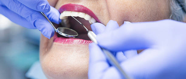 Best Dental Abscess Treatment in Highlands, TX